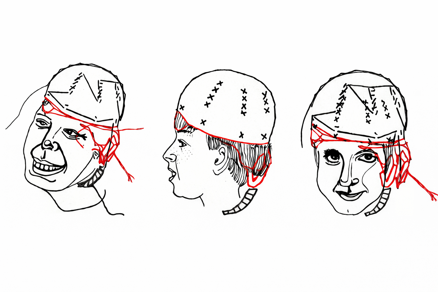 HappyAccidents_Helmet HappyAccidents_Helmet